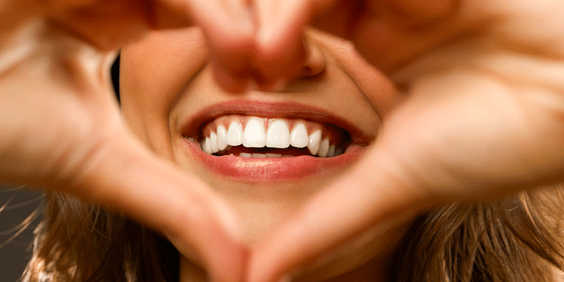 Cosmetic dentist, Teeth whitening & bleching dental veneers, teeth bonding