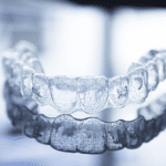 Little pearls invisalign center Bangalore