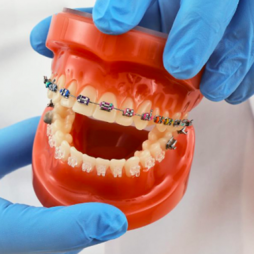 What is an orthodontist? What is an orthodontist